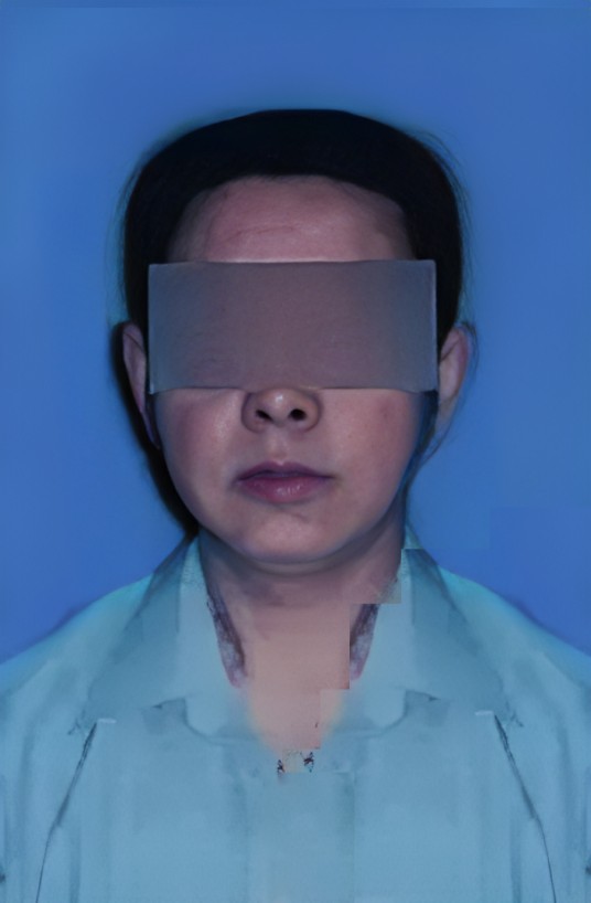 王立军（2020年辽宁省丹东市开锁被炸身亡当事人）