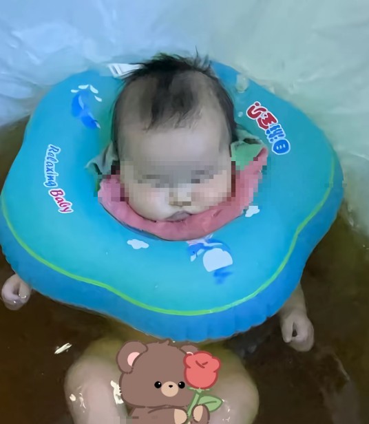 1·16罗平女婴泡药浴后离世事件