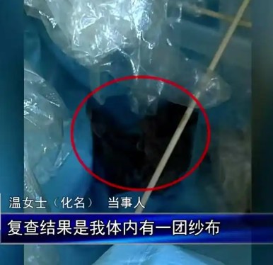 9·12呼和浩特女子术后体内残留纱布事件