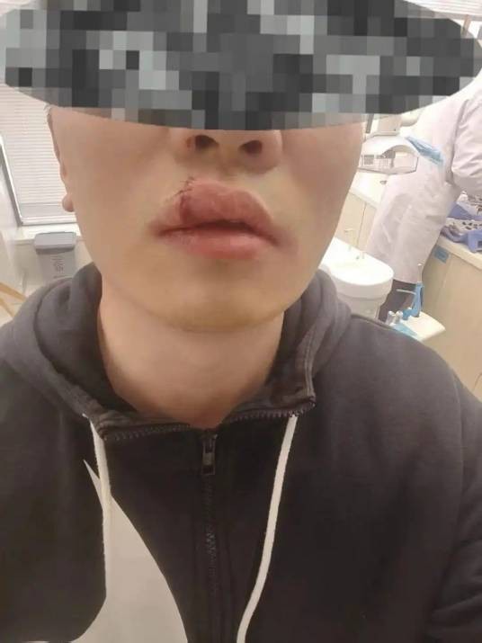 3·11小鹏充电枪砸伤车主事件