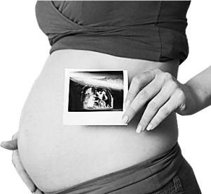 胎儿写真