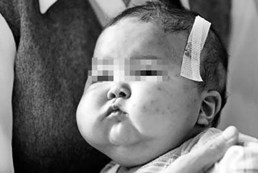 2003年阜阳劣质奶粉事件