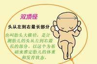 双顶径