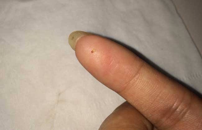 跳蚤一般藏在在人身上哪个地方？