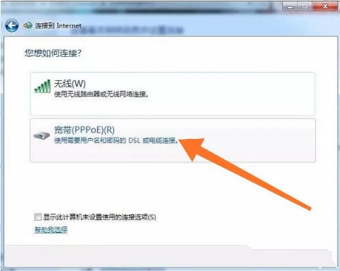 电脑怎么连接校园网络