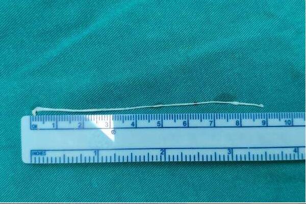 5mm等于多少厘米