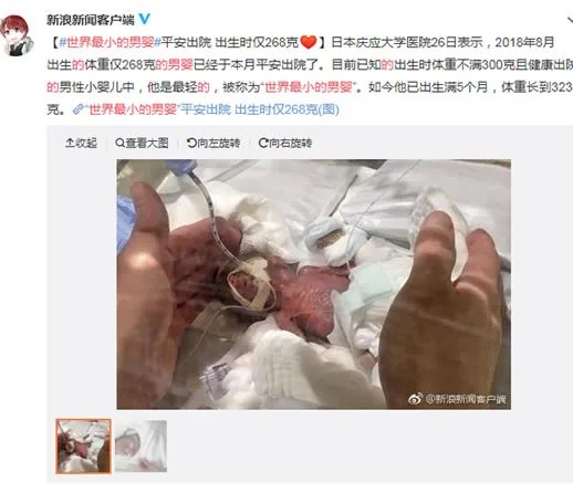 世界最小男婴有多小及照片:详情真相曝光(图)