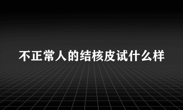 不正常人的结核皮试什么样