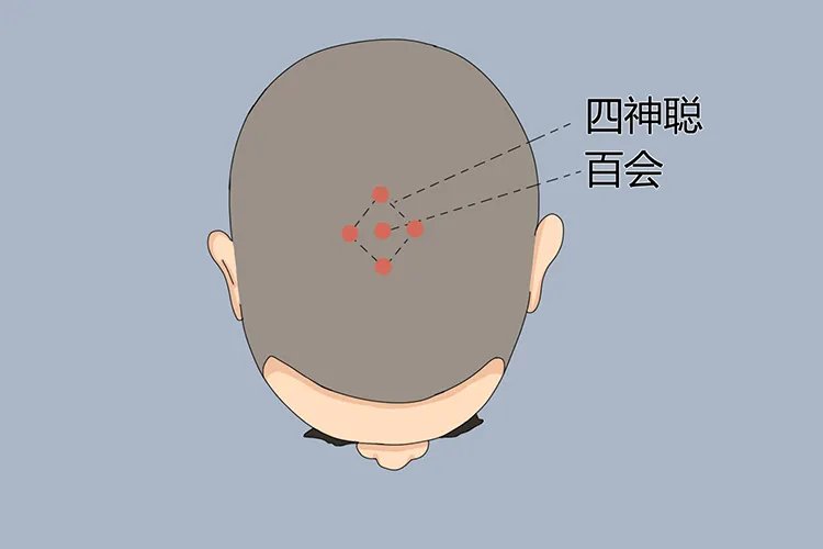 治疗失眠的三个穴位