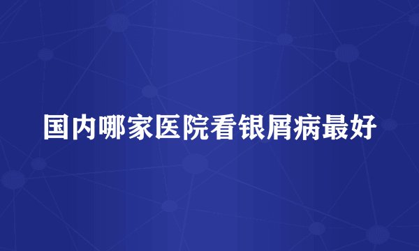 国内哪家医院看银屑病最好