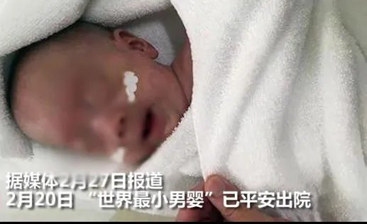 世界最小男婴有多小及照片:详情真相曝光(图)