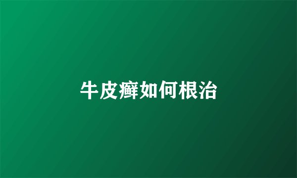 牛皮癣如何根治