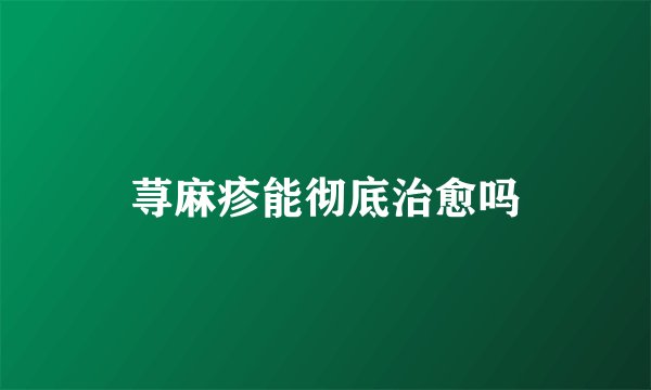 荨麻疹能彻底治愈吗