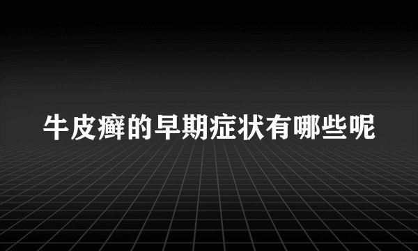 牛皮癣的早期症状有哪些呢