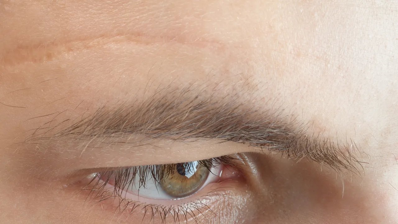 脸上的疤如何去除