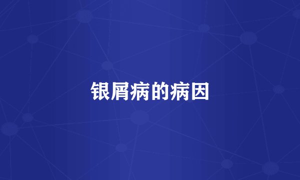 银屑病的病因