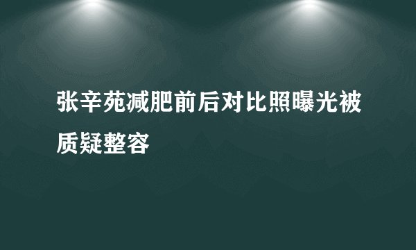 张辛苑减肥前后对比照曝光被质疑整容