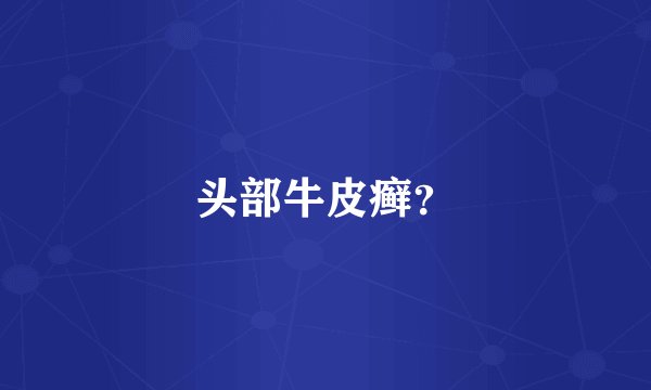 头部牛皮癣？