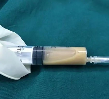 女子收养流浪猫狗感染细菌是真的吗?