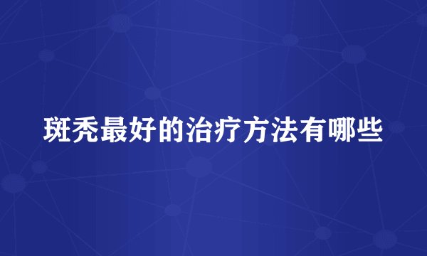 斑秃最好的治疗方法有哪些