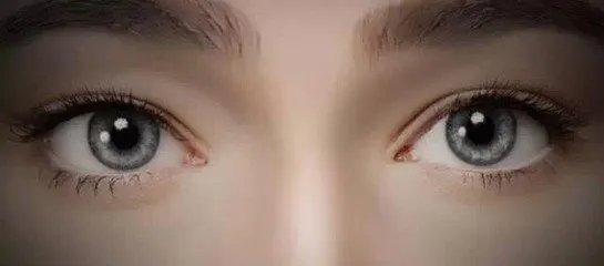 双眼皮全切多少钱