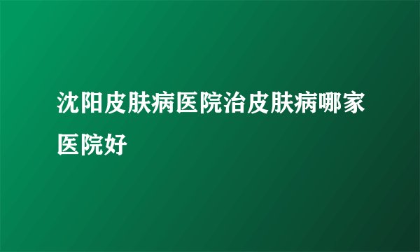 沈阳皮肤病医院治皮肤病哪家医院好