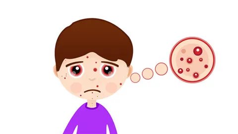 青春痘怎么能治好