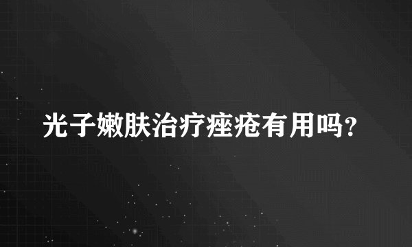 光子嫩肤治疗痤疮有用吗？