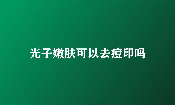 光子嫩肤可以去痘印吗