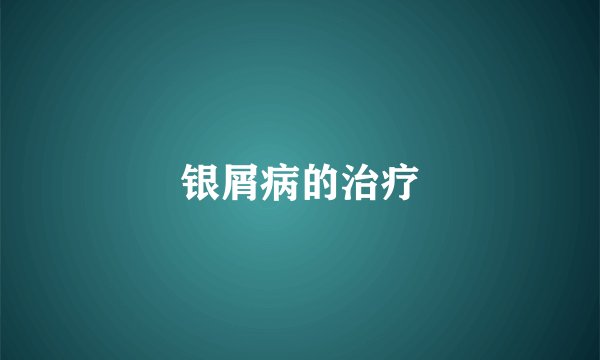 银屑病的治疗