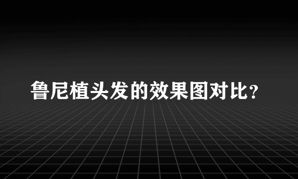 鲁尼植头发的效果图对比？