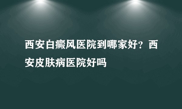 西安白癜风医院到哪家好？西安皮肤病医院好吗