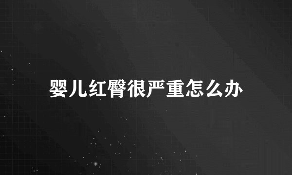 婴儿红臀很严重怎么办