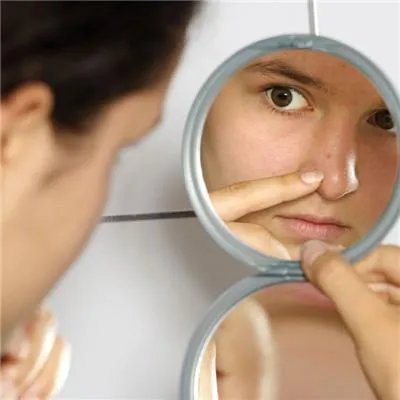 治疗痤疮色斑