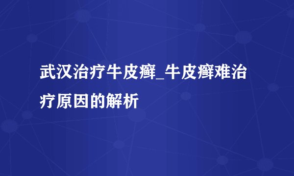 武汉治疗牛皮癣_牛皮癣难治疗原因的解析