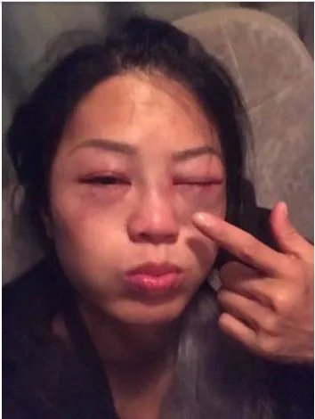 女星录节目为什么会被暴打?