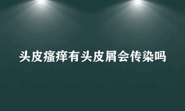 头皮瘙痒有头皮屑会传染吗