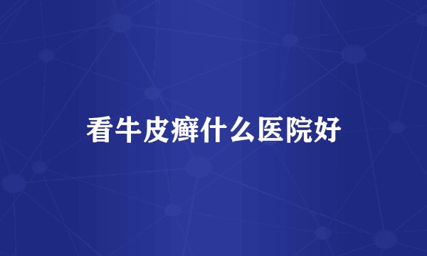 看牛皮癣什么医院好