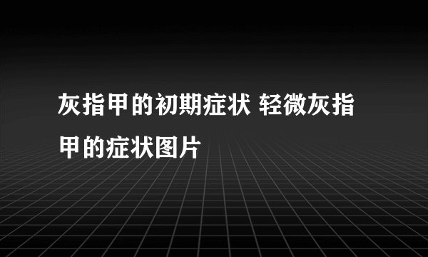灰指甲的初期症状 轻微灰指甲的症状图片