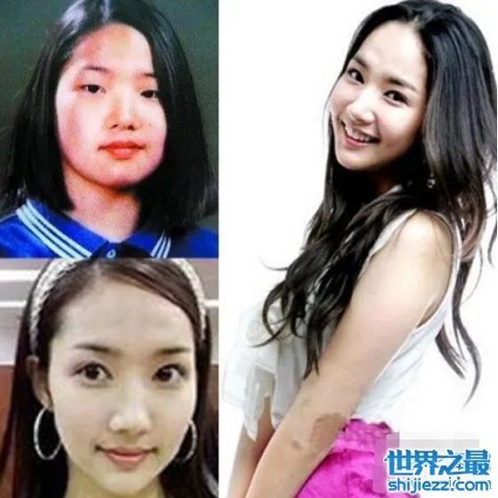 朴敏英整容前后照片对比,简直丑女大翻身