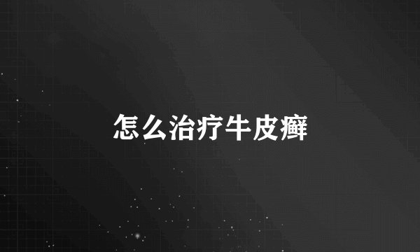 怎么治疗牛皮癣