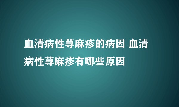 血清病性荨麻疹的病因 血清病性荨麻疹有哪些原因